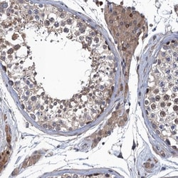 MDM1 Antibody, Novus Biologicals 0.1mL; Unlabeled:Antibodies, Polyclonal
